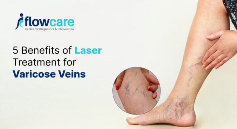 Laser Treatment for Varicose Veins (2)