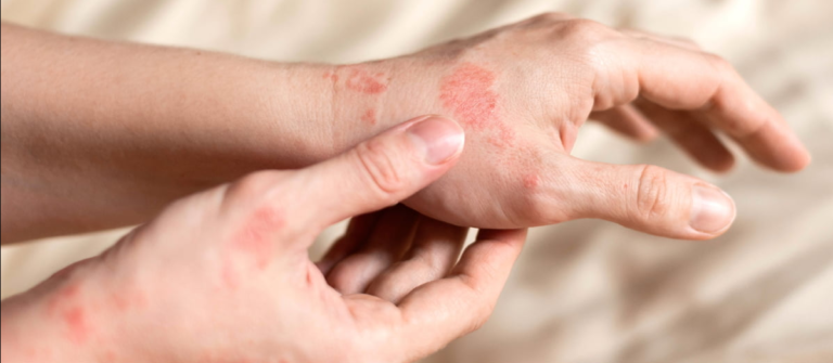 Buy Generic Amoxil Online