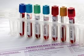 Where Can You Book Blood Tests in Luton Quickly and Safely?