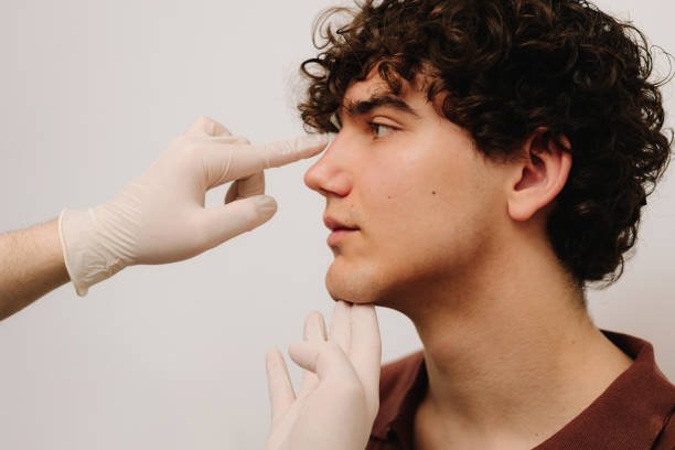 Rhinoplasty in Riyadh