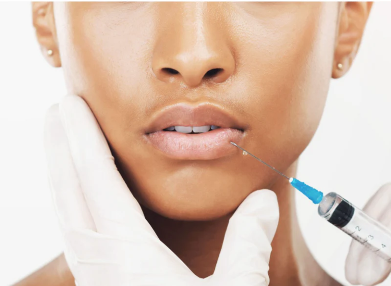 Lip Fillers at The Medispa: Enhance, Define, and Embrace Your Natural Smile