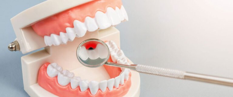 dental implants in Converse TX