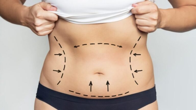 Staying Safe Tips from Best Liposuction Doctors in Dubai Liposuction in Dubai