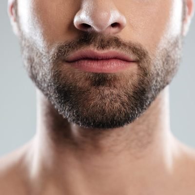 Beard Transplant in Dubai for a Fuller Masculine Look