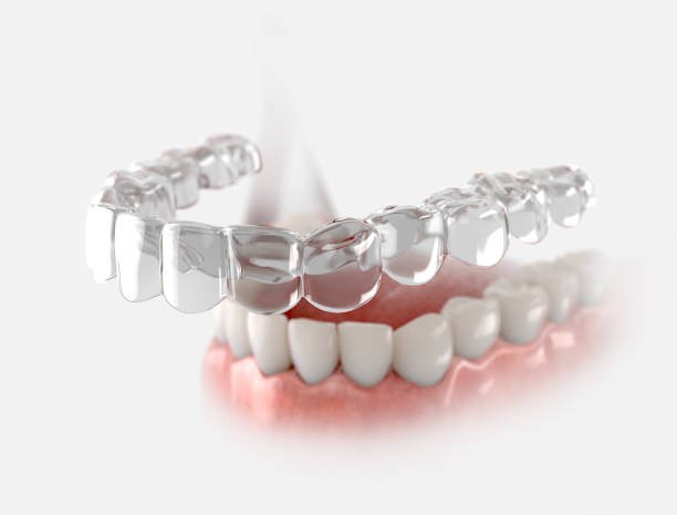 Clear Smile Confidence Starts with Invisalign in Mission Viejo