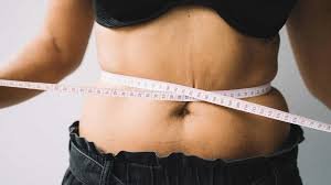 Tummy Tuck Adelaide: Abdominoplasty Costs, Recovery & Results Explained tummy tuck in Adelaide