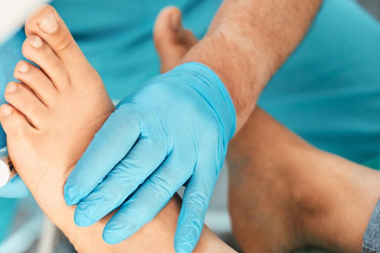 Advanced Clinical Treatments for Persistent Verrucas Edinburgh