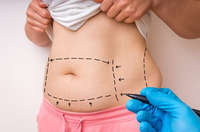 Emotional Benefits of a Mommy Makeover in Dubai